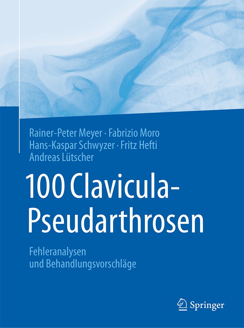 Titlebook: 100 Clavicula-Pseudarthrosen; Fehleranalysen und B Rainer-Peter Meyer,Fabrizio Moro,Fritz Hefti Book 2018 Springer-Verlag GmbH Deutschland Titlebook: 100 Clavicula-Pseudarthrosen; Fehleranalysen und B Rainer-Peter Meyer,Fabrizio Moro,Fritz Hefti Book 2018 Springer-Verlag GmbH Deutschland