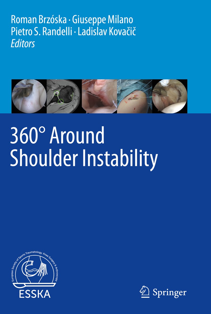 Titlebook: 360° Around Shoulder Instability; Roman Brzóska,Giuseppe Milano,Ladislav Kovačič Book 2020 ESSKA 2020 Arthroscopy.Bony Procedures.Shoulder Titlebook: 360° Around Shoulder Instability; Roman Brzóska,Giuseppe Milano,Ladislav Kovačič Book 2020 ESSKA 2020 Arthroscopy.Bony Procedures.Shoulder