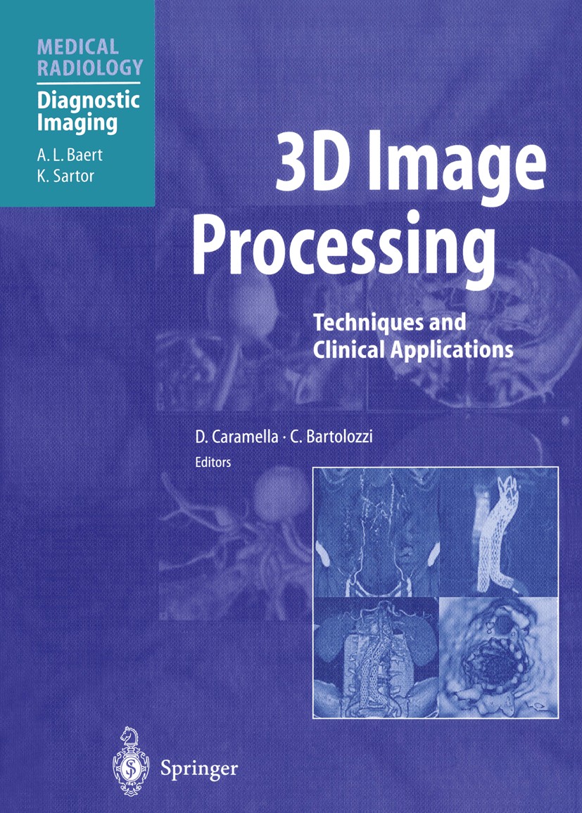 Titlebook: 3D Image Processing; Techniques and Clini Davide Caramella,Carlo Bartolozzi Book 2002 Springer-Verlag Berlin Heidelberg 2002 Surgery.brain. Titlebook: 3D Image Processing; Techniques and Clini Davide Caramella,Carlo Bartolozzi Book 2002 Springer-Verlag Berlin Heidelberg 2002 Surgery.brain.