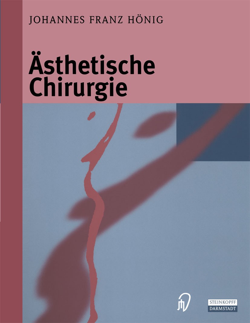 Titlebook: Ästhetische Chirurgie; Johannes Franz Hönig Book 2000 Springer-Verlag Berlin Heidelberg 2000 Abdominalsplastik.Abdominoplastik.Antehelixpl Titlebook: Ästhetische Chirurgie; Johannes Franz Hönig Book 2000 Springer-Verlag Berlin Heidelberg 2000 Abdominalsplastik.Abdominoplastik.Antehelixpl