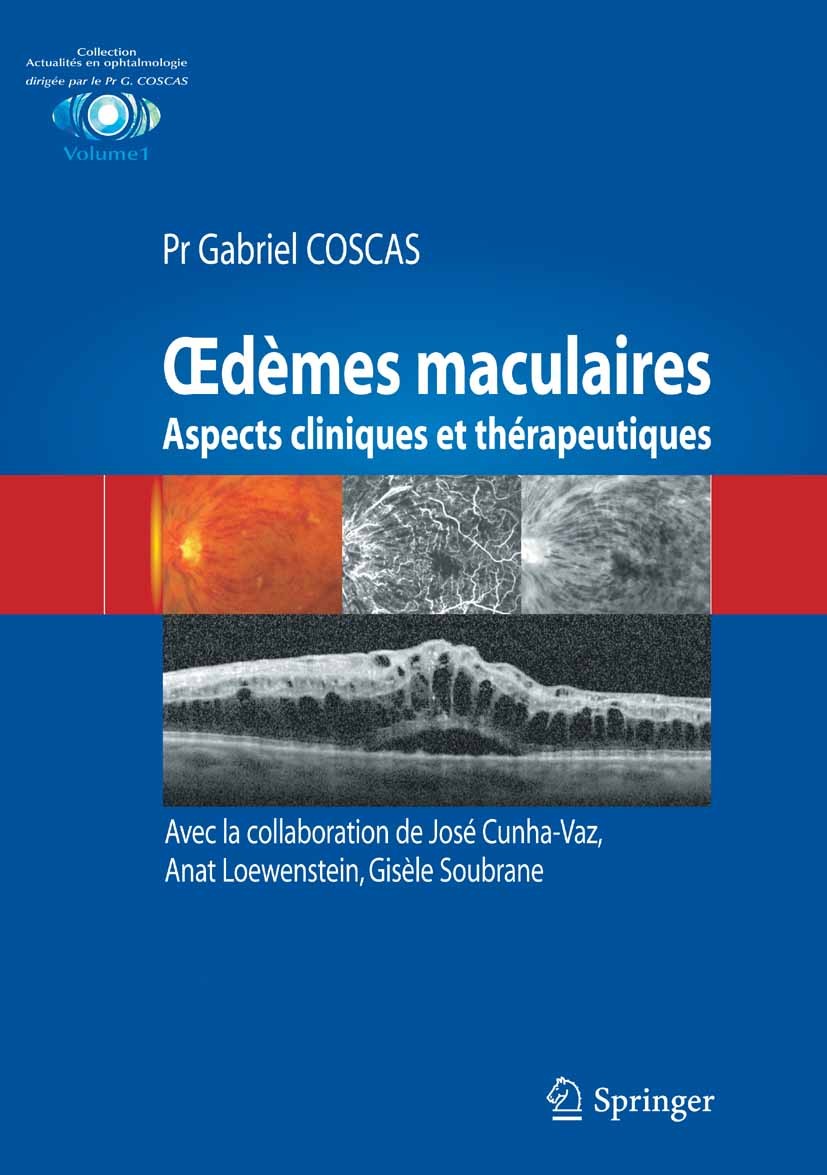 Titlebook: Œdèmes maculaires; Aspects cliniques et Gabriel Coscas Book 2011Latest edition Springer-Verlag France 2011 DMLA.Diabète.Occlusions veineuse Titlebook: Œdèmes maculaires; Aspects cliniques et Gabriel Coscas Book 2011Latest edition Springer-Verlag France 2011 DMLA.Diabète.Occlusions veineuse