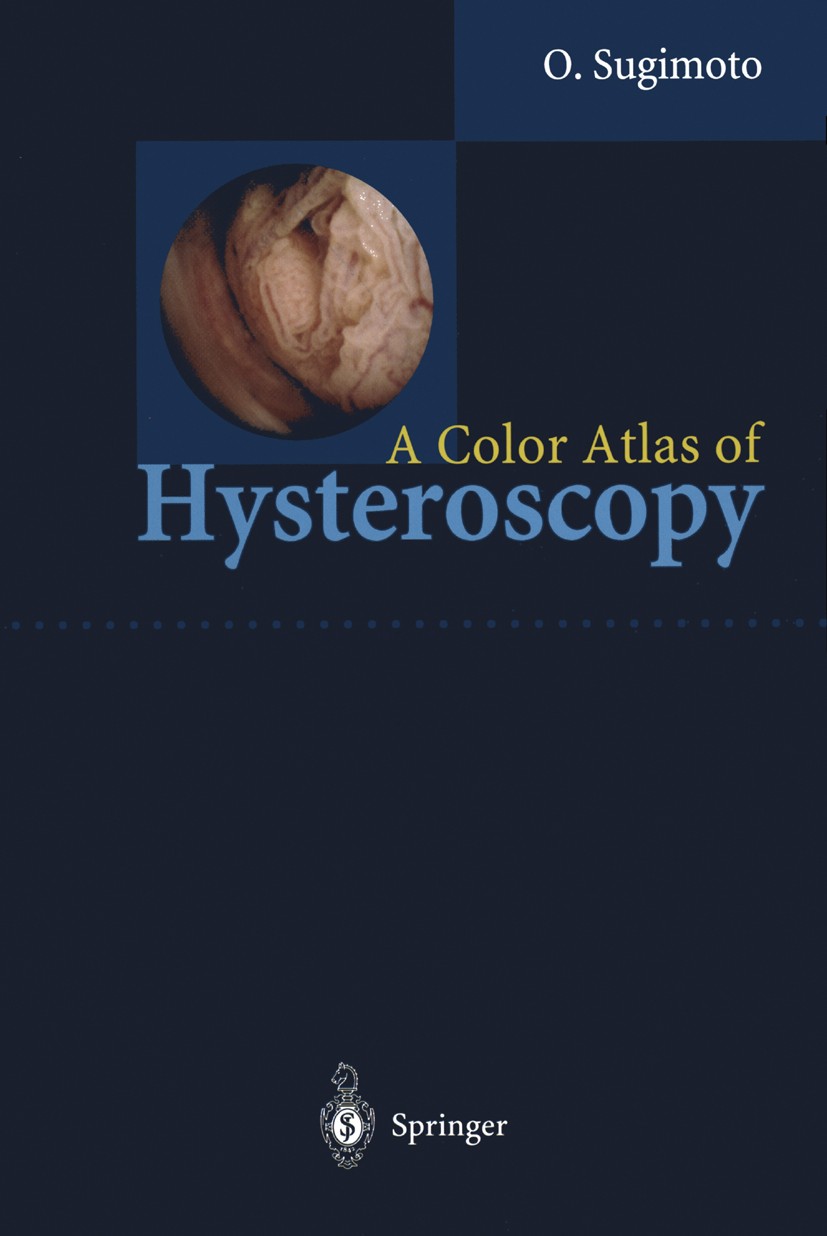 Titlebook: A Color Atlas of Hysteroscopy; Osamu Sugimoto Book 1999 Springer-Verlag Tokyo 1999 Endometrium.Tumor.Uterus.endoscopy.hormone therapy.horm Titlebook: A Color Atlas of Hysteroscopy; Osamu Sugimoto Book 1999 Springer-Verlag Tokyo 1999 Endometrium.Tumor.Uterus.endoscopy.hormone therapy.horm