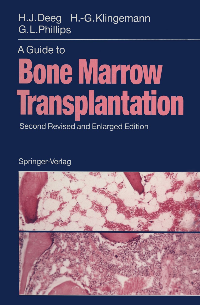 Titlebook: A Guide to Bone Marrow Transplantation; H. Joachim Deeg,Hans-Georg Klingemann,Gordon L. Ph Book 19922nd edition Springer-Verlag Berlin Hei Titlebook: A Guide to Bone Marrow Transplantation; H. Joachim Deeg,Hans-Georg Klingemann,Gordon L. Ph Book 19922nd edition Springer-Verlag Berlin Hei