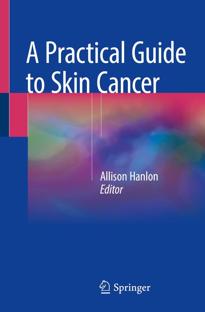 Titlebook: A Practical Guide to Skin Cancer; Allison Hanlon Book 2018 Springer International Publishing AG, part of Springer Nature 2018 carcinoma.de Titlebook: A Practical Guide to Skin Cancer; Allison Hanlon Book 2018 Springer International Publishing AG, part of Springer Nature 2018 carcinoma.de