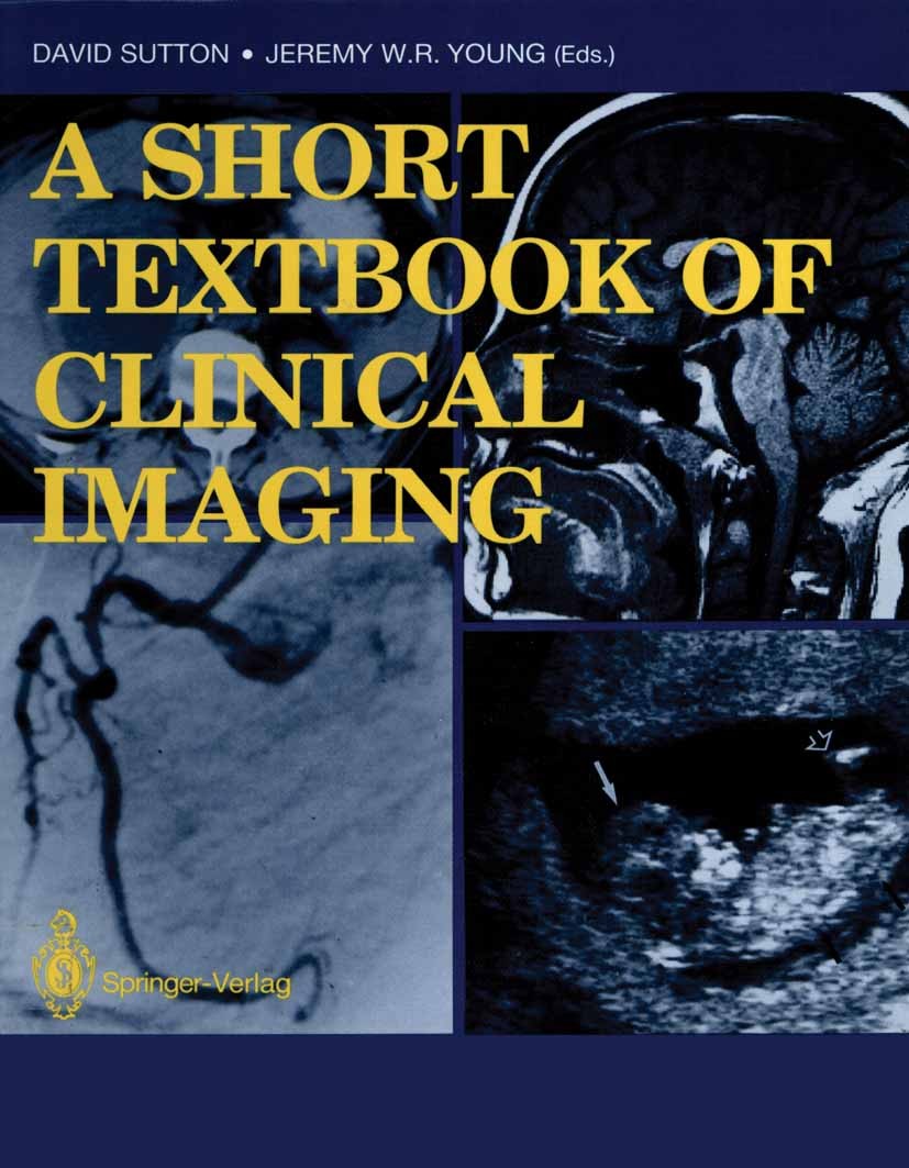 Titlebook: A Short Textbook of Clinical Imaging; David Sutton (Consulting Radiologist),Jeremy W. R. Book 1990 Springer-Verlag London 1990 Bildgebende Titlebook: A Short Textbook of Clinical Imaging; David Sutton (Consulting Radiologist),Jeremy W. R. Book 1990 Springer-Verlag London 1990 Bildgebende