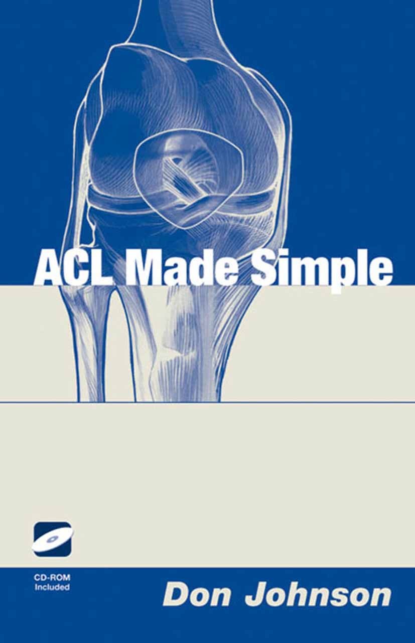 Titlebook: ACL Made Simple; Don Johnson Book 2004 Springer Science+Business Media New York 2004 complication.complications.rehabilitation.surgical te Titlebook: ACL Made Simple; Don Johnson Book 2004 Springer Science+Business Media New York 2004 complication.complications.rehabilitation.surgical te