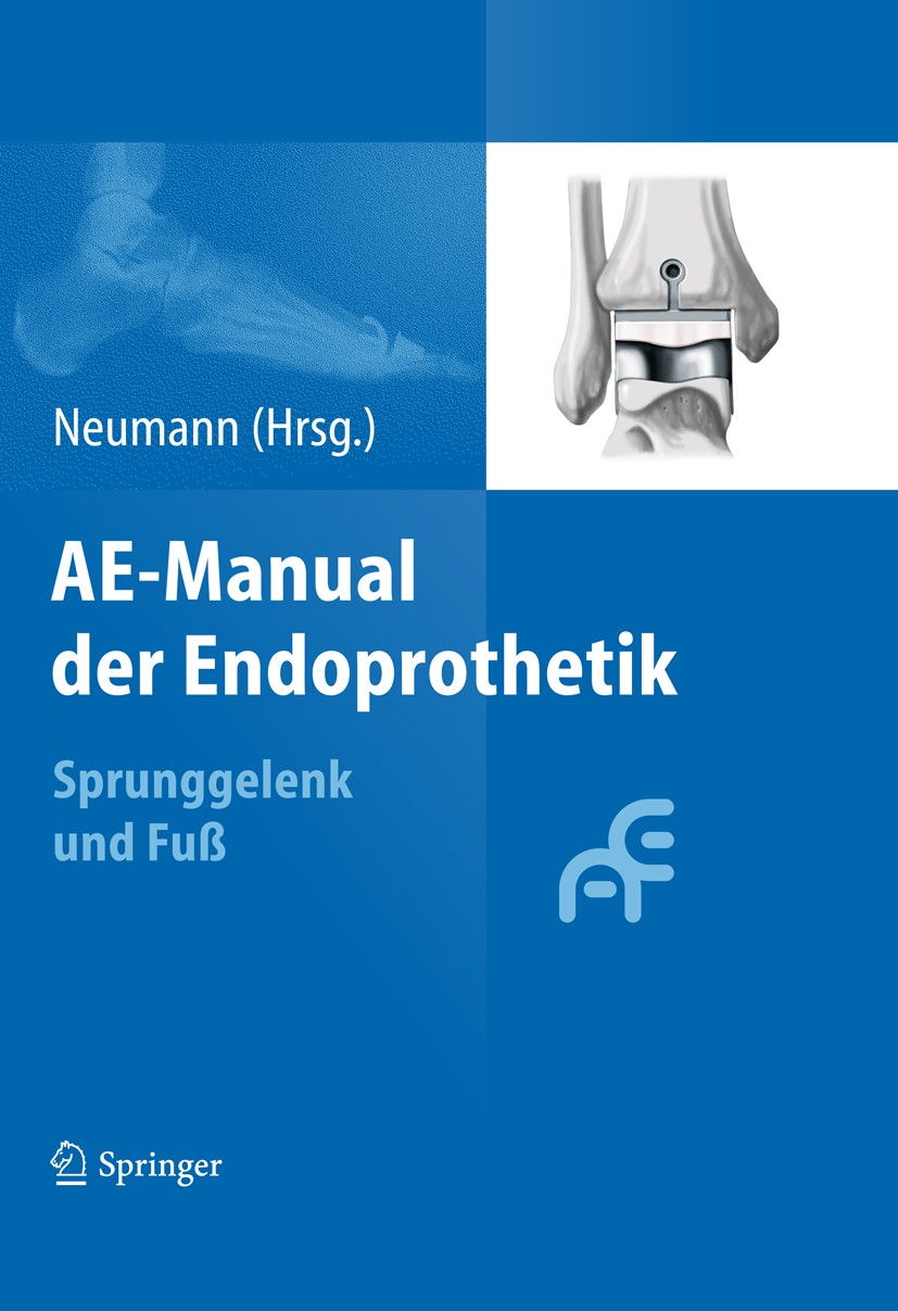 Titlebook: AE-Manual der Endoprothetik; Sprunggelenk und Fuß Hans Wolfram Neumann Book 2012 Arbeitsgemeinschaft Endoprothetik 2012 Hallus rigidus.Hall Titlebook: AE-Manual der Endoprothetik; Sprunggelenk und Fuß Hans Wolfram Neumann Book 2012 Arbeitsgemeinschaft Endoprothetik 2012 Hallus rigidus.Hall