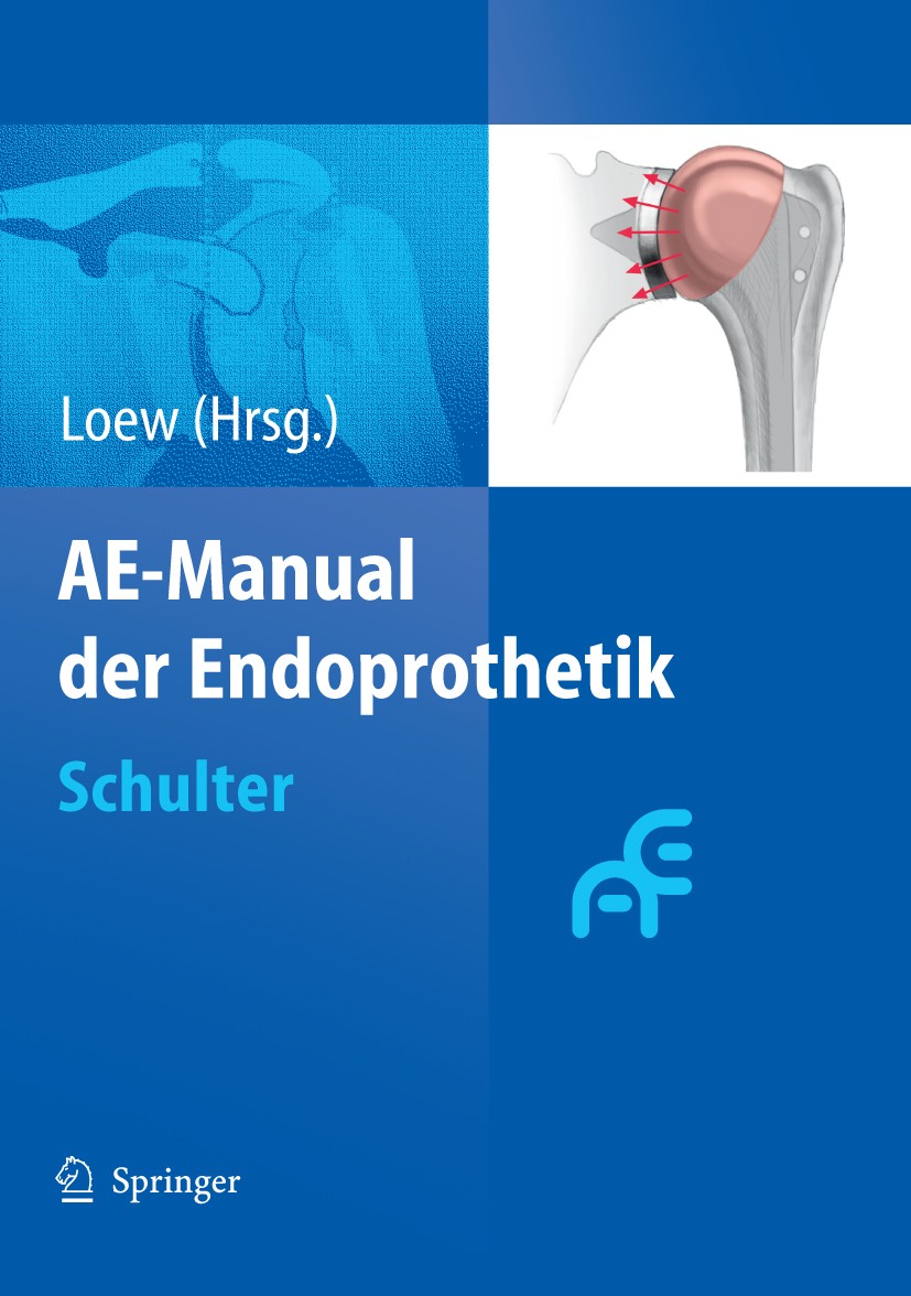 Titlebook: AE-Manual der Endoprothetik; Schulter Markus Loew Book 2010 Springer-Verlag Berlin Heidelberg 2010 Anatomie.Biomechanik.Chirurgie.Endoproth Titlebook: AE-Manual der Endoprothetik; Schulter Markus Loew Book 2010 Springer-Verlag Berlin Heidelberg 2010 Anatomie.Biomechanik.Chirurgie.Endoproth