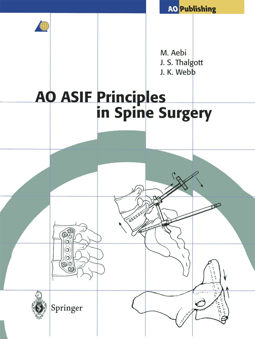Titlebook: AO ASIF Principles in Spine Surgery; Max Aebi,John S. Thalgott,John K. Webb Book 1998 Springer-Verlag Berlin Heidelberg 1998 Instrument.Su Titlebook: AO ASIF Principles in Spine Surgery; Max Aebi,John S. Thalgott,John K. Webb Book 1998 Springer-Verlag Berlin Heidelberg 1998 Instrument.Su