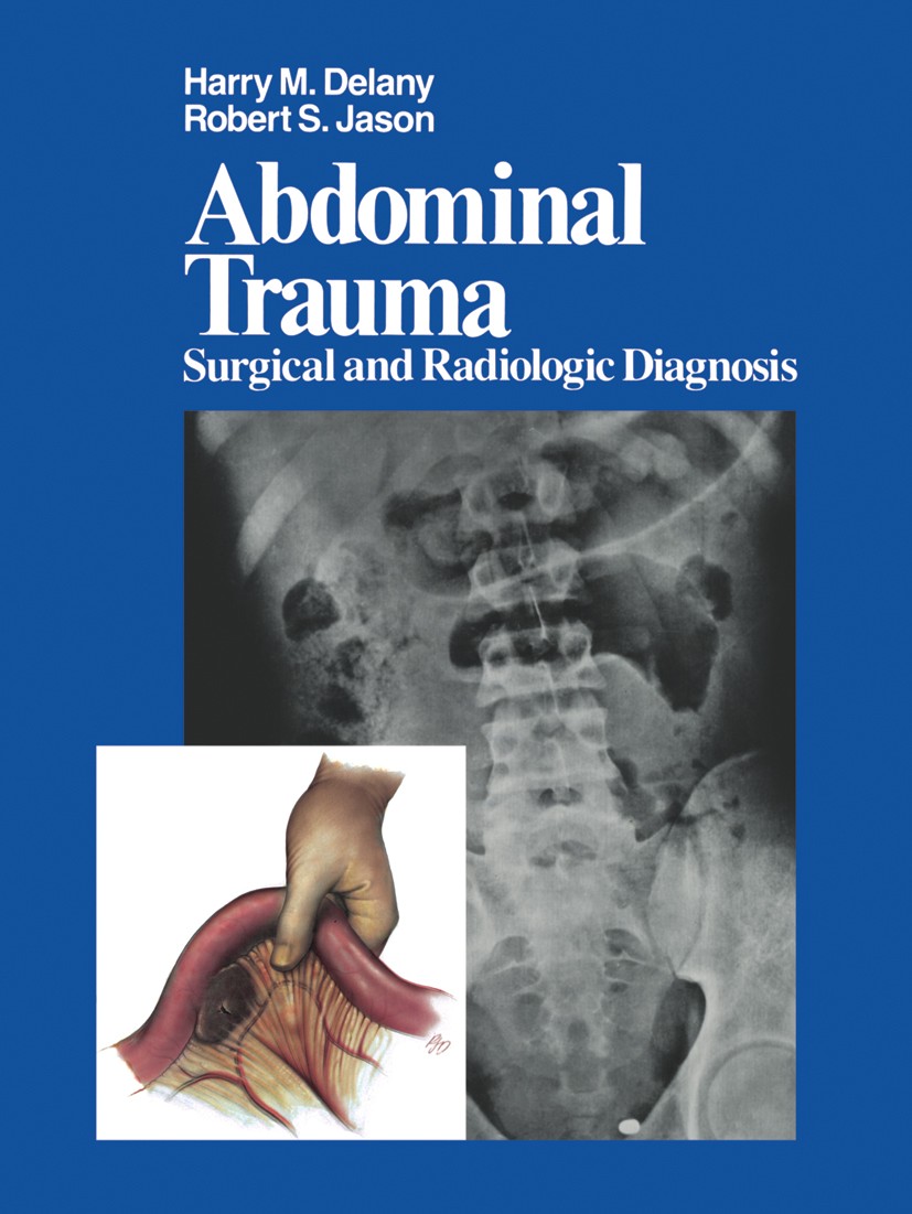 Titlebook: Abdominal Trauma; Surgical and Radiolo Harry M. Delany,Robert S. Jason Book 1981 Springer-Verlag New York Inc. 1981 Bauchverletzung.Surgery Titlebook: Abdominal Trauma; Surgical and Radiolo Harry M. Delany,Robert S. Jason Book 1981 Springer-Verlag New York Inc. 1981 Bauchverletzung.Surgery
