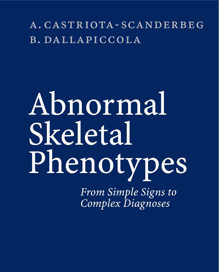 Titlebook: Abnormal Skeletal Phenotypes; From Simple Signs to Alessandro Castriota-Scanderbeg,Bruno Dallapiccola Book 2005 Springer-Verlag Berlin Heid Titlebook: Abnormal Skeletal Phenotypes; From Simple Signs to Alessandro Castriota-Scanderbeg,Bruno Dallapiccola Book 2005 Springer-Verlag Berlin Heid