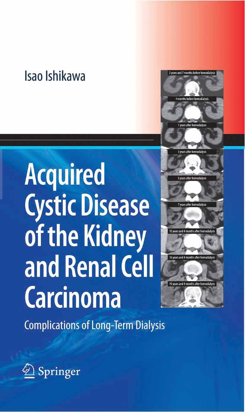 Titlebook: Acquired Cystic Disease of the Kidney and Renal Cell Carcinoma; Complication of Long Isao Ishikawa Book 2007 Springer-Verlag Tokyo 2007 CT. Titlebook: Acquired Cystic Disease of the Kidney and Renal Cell Carcinoma; Complication of Long Isao Ishikawa Book 2007 Springer-Verlag Tokyo 2007 CT.