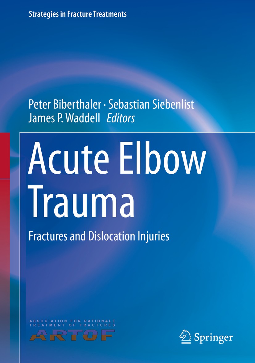 Titlebook: Acute Elbow Trauma; Fractures and Disloc Peter Biberthaler,Sebastian Siebenlist,James P. Wa Book 2019 Springer Nature Switzerland AG 2019 C Titlebook: Acute Elbow Trauma; Fractures and Disloc Peter Biberthaler,Sebastian Siebenlist,James P. Wa Book 2019 Springer Nature Switzerland AG 2019 C