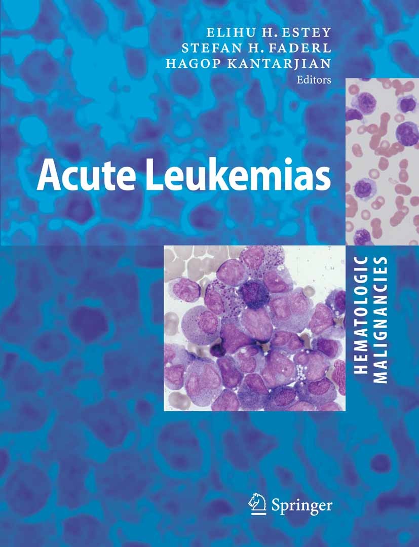 Titlebook: Hematologic Malignancies: Acute Leukemias; E. H. Estey,S. H. Faderl,H. M. Kantarjian Book 20081st edition Springer-Verlag Berlin Heidelber Titlebook: Hematologic Malignancies: Acute Leukemias; E. H. Estey,S. H. Faderl,H. M. Kantarjian Book 20081st edition Springer-Verlag Berlin Heidelber