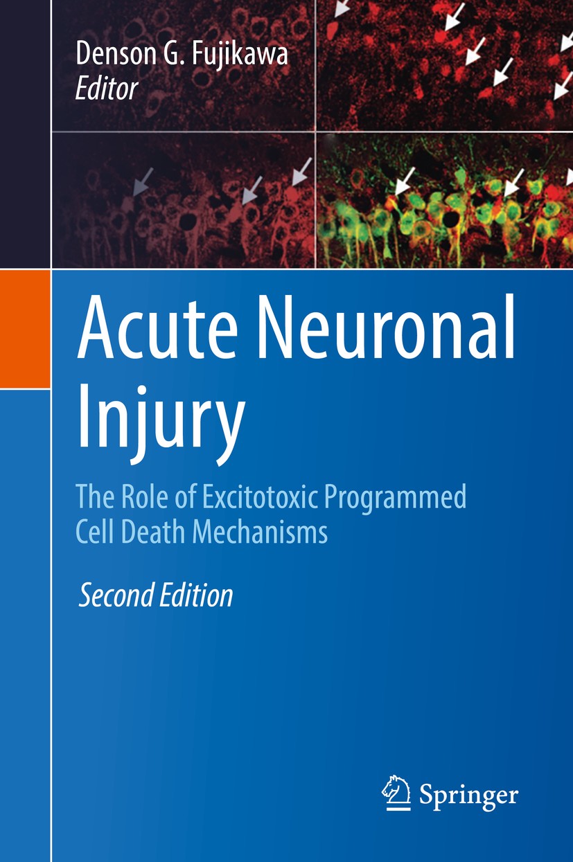 Titlebook: Acute Neuronal Injury; The Role of Excitoto Denson G. Fujikawa Book 2018Latest edition Springer International Publishing AG, part of Spring Titlebook: Acute Neuronal Injury; The Role of Excitoto Denson G. Fujikawa Book 2018Latest edition Springer International Publishing AG, part of Spring