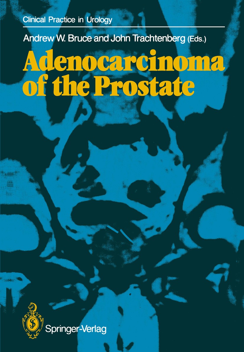 Titlebook: Adenocarcinoma of the Prostate; Andrew W. Bruce (Professor and Chairman),John Trac Book 1987 Springer-Verlag Berlin Heidelberg 1987 Gradin Titlebook: Adenocarcinoma of the Prostate; Andrew W. Bruce (Professor and Chairman),John Trac Book 1987 Springer-Verlag Berlin Heidelberg 1987 Gradin