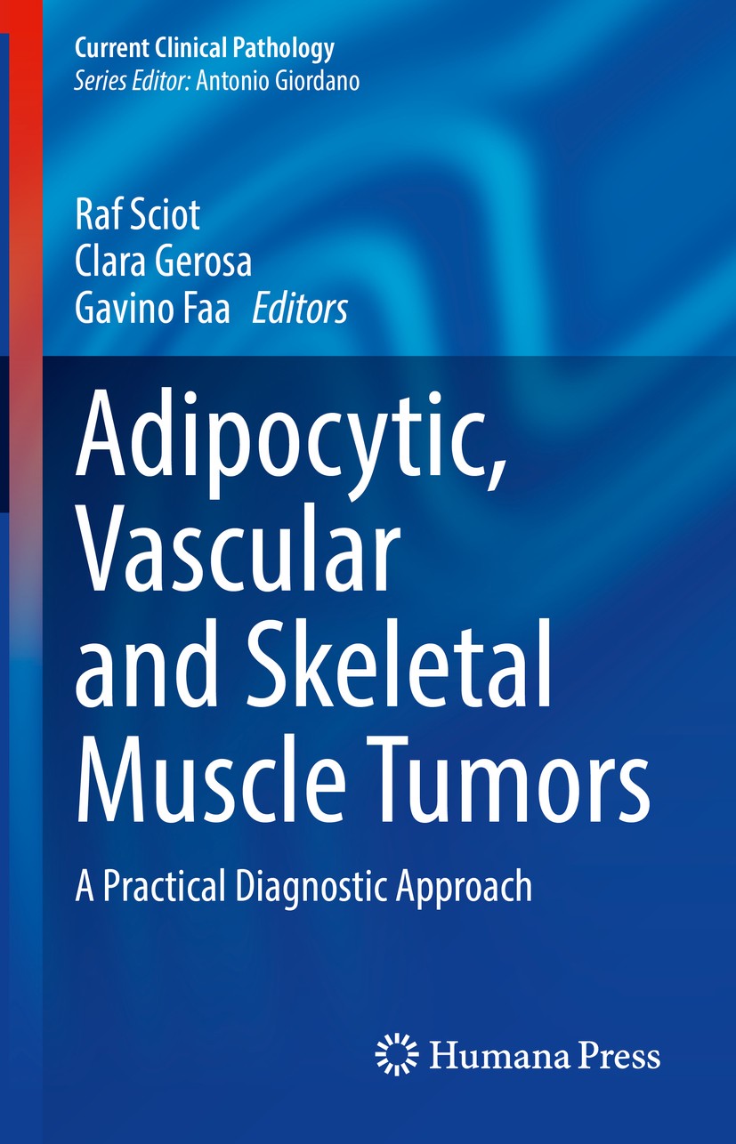 Titlebook: Adipocytic, Vascular and Skeletal Muscle Tumors; A Practical Diagnost Raf Sciot,Clara Gerosa,Gavino Faa Book 2020 Springer Nature Switzerla Titlebook: Adipocytic, Vascular and Skeletal Muscle Tumors; A Practical Diagnost Raf Sciot,Clara Gerosa,Gavino Faa Book 2020 Springer Nature Switzerla
