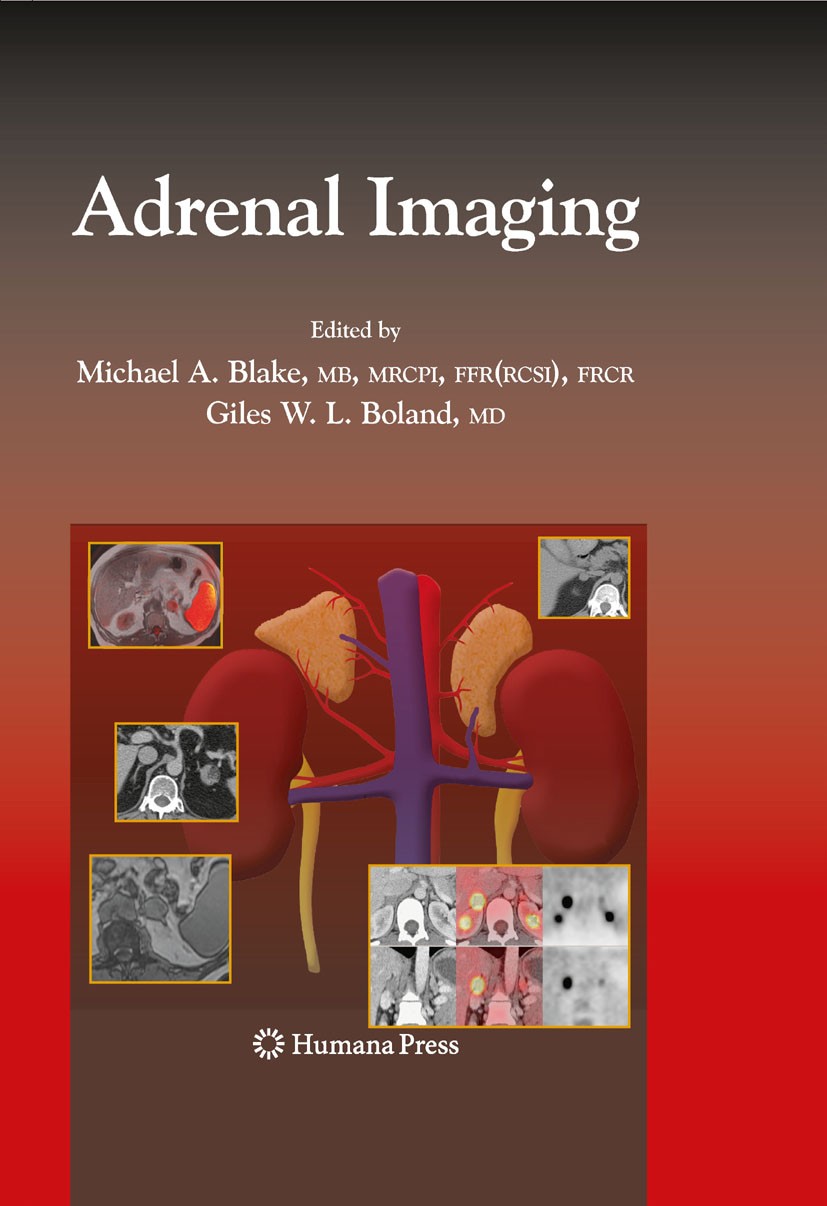 Titlebook: Adrenal Imaging; Michael A.‘Blake,Giles Boland Book 2009 Humana Press 2009 Adrenal Dysfunction.Adrenal Embryology and Pathology.Adrenal Gl Titlebook: Adrenal Imaging; Michael A.‘Blake,Giles Boland Book 2009 Humana Press 2009 Adrenal Dysfunction.Adrenal Embryology and Pathology.Adrenal Gl