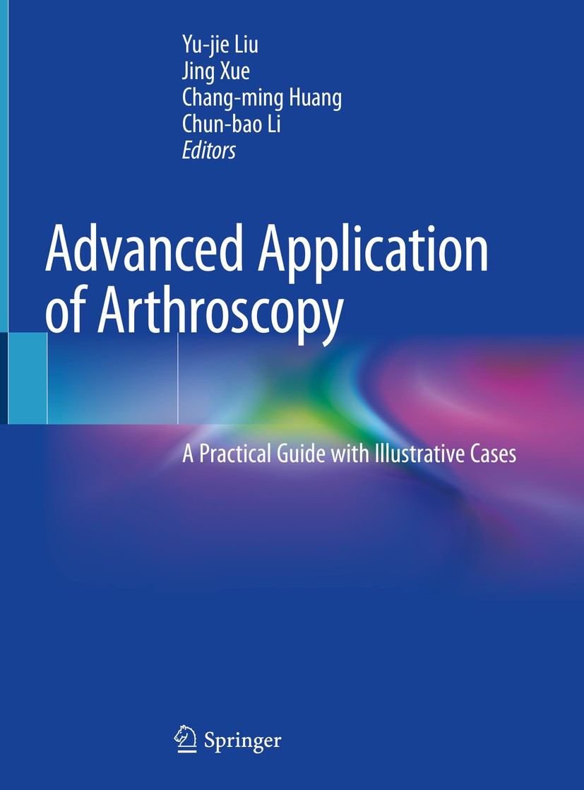 Titlebook: Advanced Application of Arthroscopy; A Practical Guide wi Yu-jie Liu,Jing Xue,Chun-bao Li Book 2020 Springer Nature Singapore Pte Ltd. 2020 Titlebook: Advanced Application of Arthroscopy; A Practical Guide wi Yu-jie Liu,Jing Xue,Chun-bao Li Book 2020 Springer Nature Singapore Pte Ltd. 2020