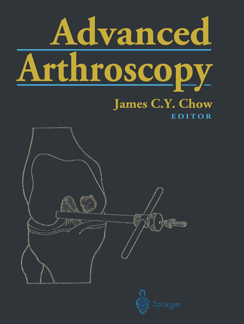 Titlebook: Advanced Arthroscopy; James C. Y. Chow (President and Founder, Director Book 2001 Springer-Verlag New York 2001 SLAP lesion.ankle.biomech Titlebook: Advanced Arthroscopy; James C. Y. Chow (President and Founder, Director Book 2001 Springer-Verlag New York 2001 SLAP lesion.ankle.biomech
