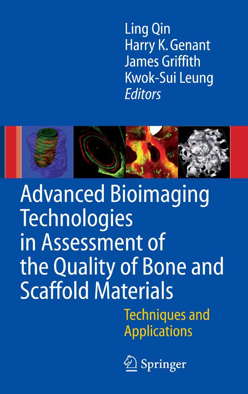 Titlebook: Advanced Bioimaging Technologies in Assessment of the Quality of Bone and Scaffold Materials; Techniques and Appli Ling Qin (Professor),Har Titlebook: Advanced Bioimaging Technologies in Assessment of the Quality of Bone and Scaffold Materials; Techniques and Appli Ling Qin (Professor),Har
