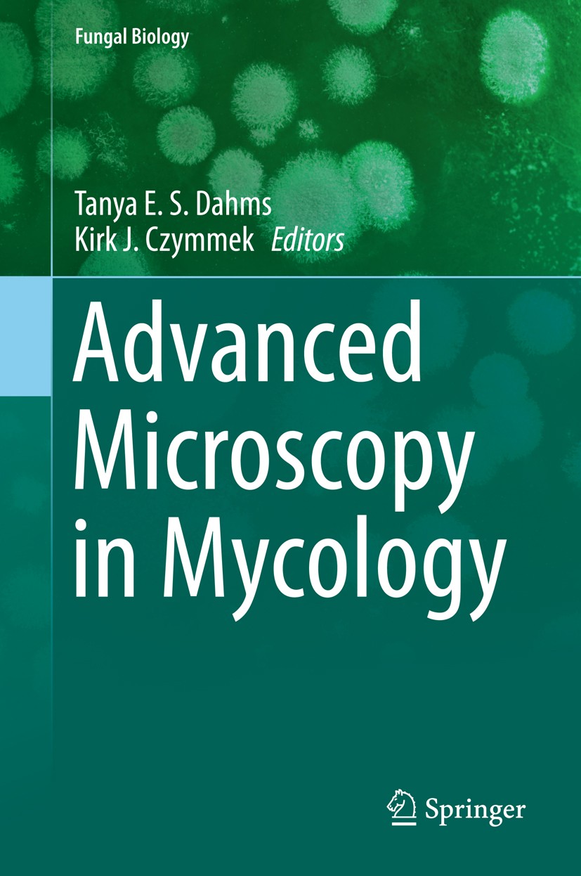 Titlebook: Advanced Microscopy in Mycology; Tanya E. S. Dahms,Kirk J. Czymmek Book 2015 The Editor(s) (if applicable) and The Author(s) 2015 Fungiopt Titlebook: Advanced Microscopy in Mycology; Tanya E. S. Dahms,Kirk J. Czymmek Book 2015 The Editor(s) (if applicable) and The Author(s) 2015 Fungiopt