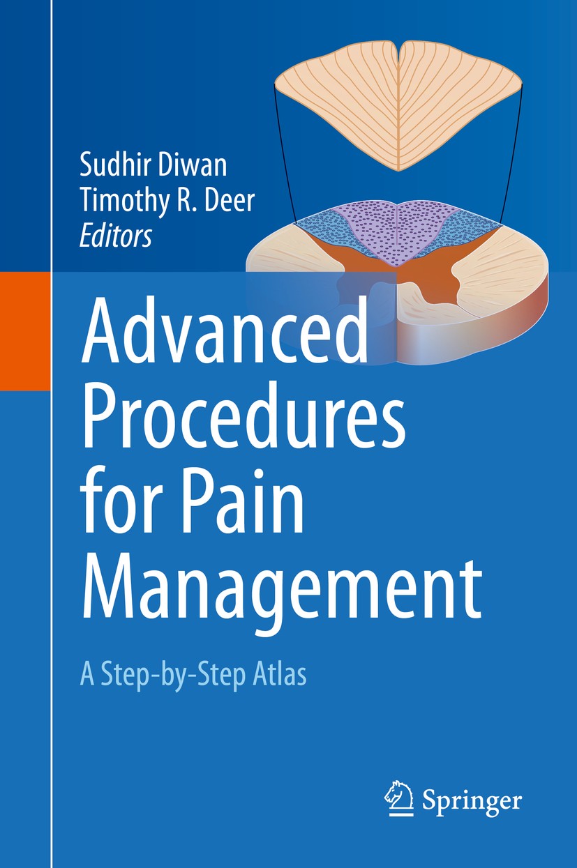 Titlebook: Advanced Procedures for Pain Management; A Step-by-Step Atlas Sudhir Diwan,Timothy R Deer Book 2018 Springer International Publishing AG, p Titlebook: Advanced Procedures for Pain Management; A Step-by-Step Atlas Sudhir Diwan,Timothy R Deer Book 2018 Springer International Publishing AG, p