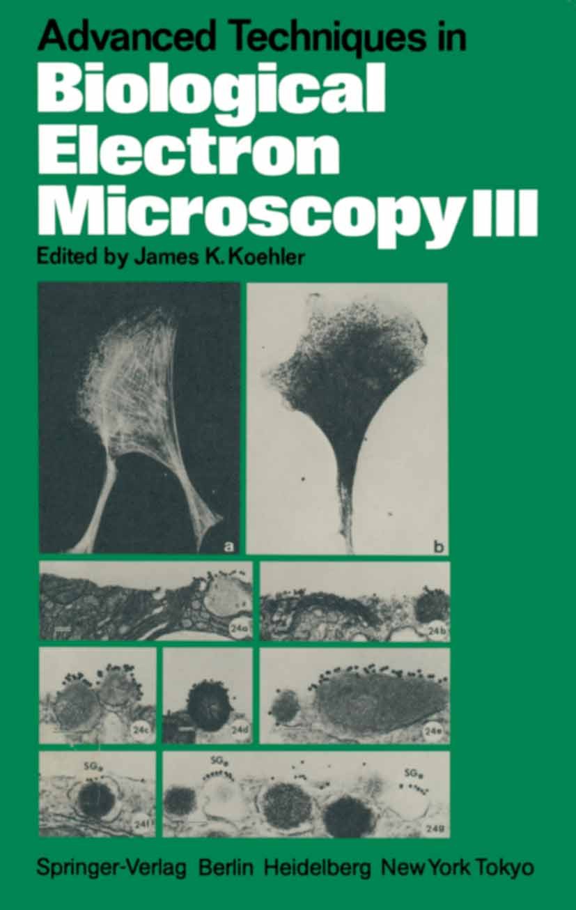 Titlebook: Advanced Techniques in Biological Electron Microscopy III; James K. Koehler Book 1986 Springer-Verlag Berlin Heidelberg 1986 Filtration.Th Titlebook: Advanced Techniques in Biological Electron Microscopy III; James K. Koehler Book 1986 Springer-Verlag Berlin Heidelberg 1986 Filtration.Th