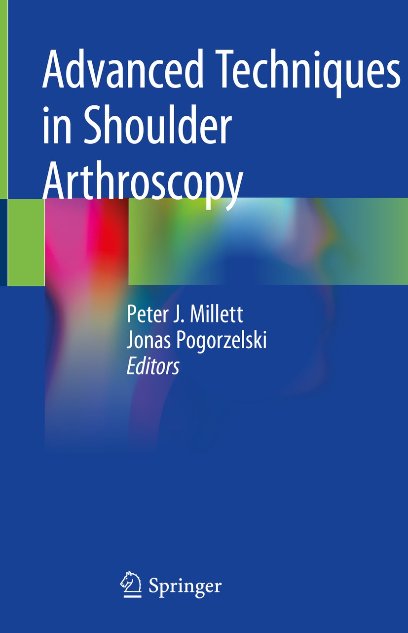 Titlebook: Advanced Techniques in Shoulder Arthroscopy; Peter J. Millett,Jonas Pogorzelski Book 2019 Springer Nature Switzerland AG 2019 Lateral decu Titlebook: Advanced Techniques in Shoulder Arthroscopy; Peter J. Millett,Jonas Pogorzelski Book 2019 Springer Nature Switzerland AG 2019 Lateral decu
