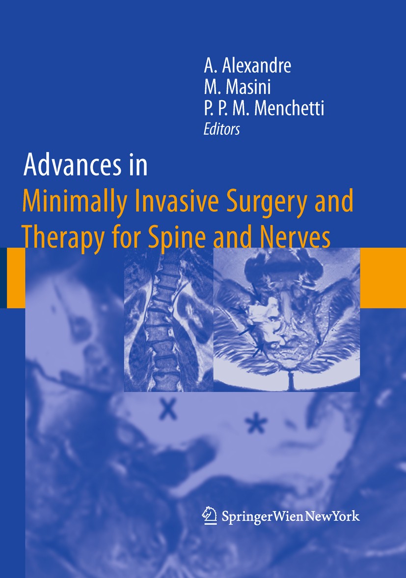 Titlebook: Advances in Minimally Invasive Surgery and Therapy for Spine and Nerves; Alberto Alexandre,Marcos Masini,Pier Paolo Maria M Book 2011 Spri Titlebook: Advances in Minimally Invasive Surgery and Therapy for Spine and Nerves; Alberto Alexandre,Marcos Masini,Pier Paolo Maria M Book 2011 Spri