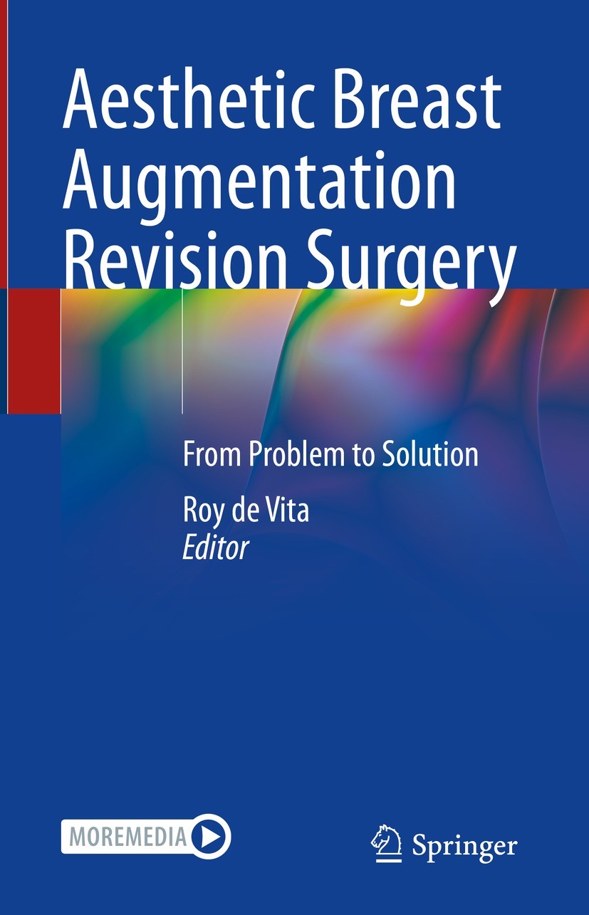Titlebook: Aesthetic Breast Augmentation Revision Surgery; From Problem to Solu Roy de Vita Book 2022 Springer Nature Switzerland AG 2022 Inframammary Titlebook: Aesthetic Breast Augmentation Revision Surgery; From Problem to Solu Roy de Vita Book 2022 Springer Nature Switzerland AG 2022 Inframammary