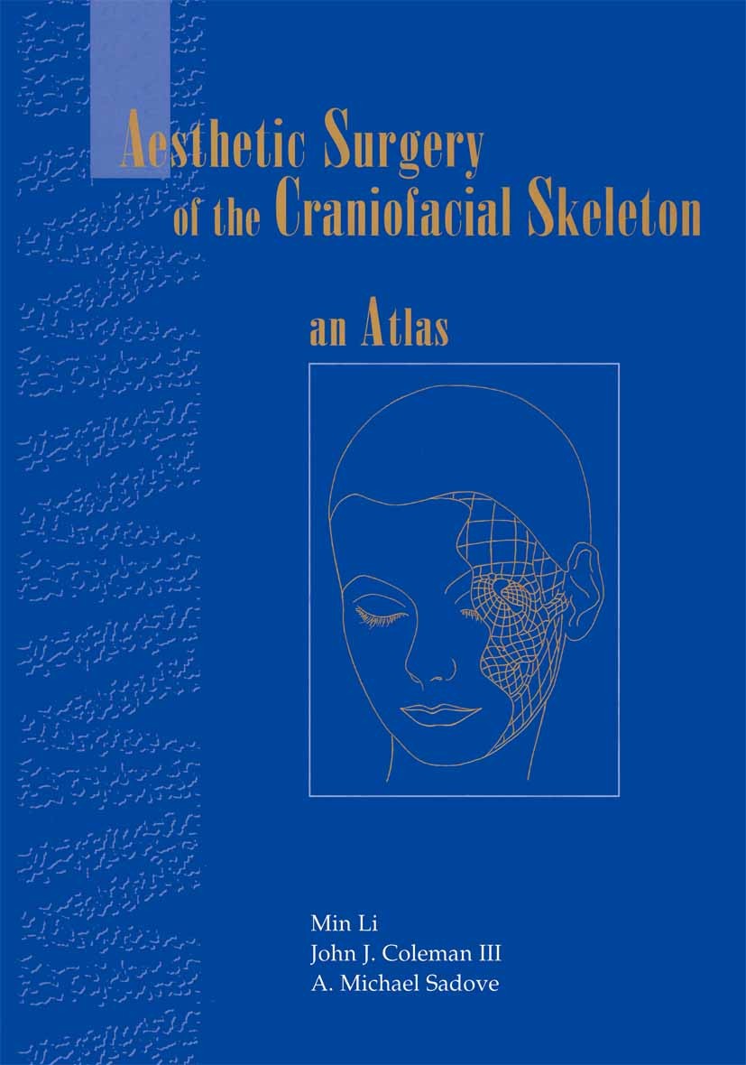 Titlebook: Aesthetic Surgery of the Craniofacial Skeleton; An Atlas Min Li,A. Michael Sadove,John J. Coleman Book 1997 Springer Science+Business Media Titlebook: Aesthetic Surgery of the Craniofacial Skeleton; An Atlas Min Li,A. Michael Sadove,John J. Coleman Book 1997 Springer Science+Business Media
