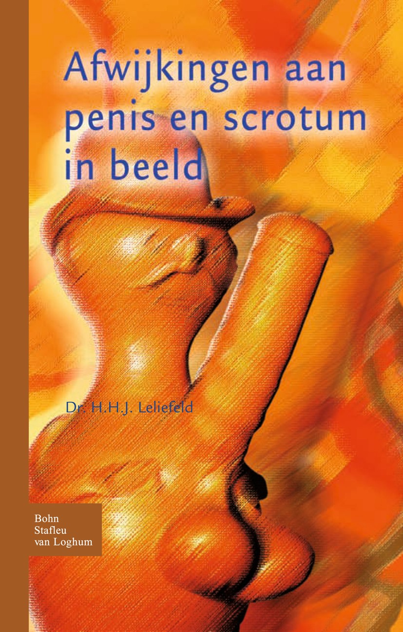 Titlebook: Afwijkingen aan penis en scrotum in beeld; H. H. J. Leliefeld Book 2008Latest edition Bohn Stafleu van Loghum 2008 Titlebook: Afwijkingen aan penis en scrotum in beeld; H. H. J. Leliefeld Book 2008Latest edition Bohn Stafleu van Loghum 2008
