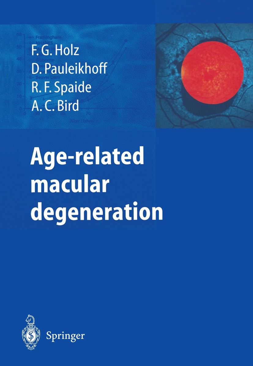 Titlebook: Age-related macular degeneration; Frank G. Holz,Daniel Pauleikhoff,Alan C. Bird Book 20041st edition Springer-Verlag Berlin Heidelberg 200 Titlebook: Age-related macular degeneration; Frank G. Holz,Daniel Pauleikhoff,Alan C. Bird Book 20041st edition Springer-Verlag Berlin Heidelberg 200