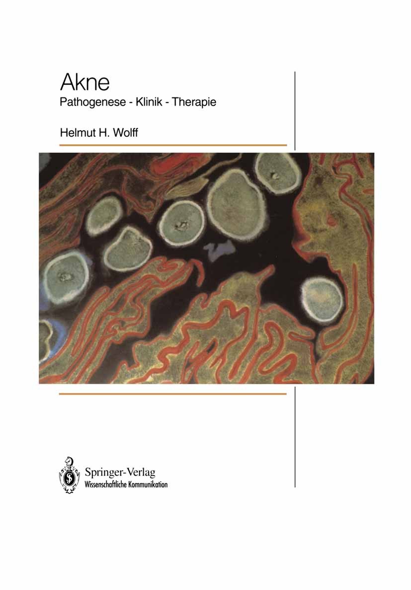 Titlebook: Akne; Pathogenese — Klinik Helmut H. Wolff Book 1992Latest edition Springer-Verlag Berlin Heidelberg New York 1992 Akne.Emotion.Endokrinium Titlebook: Akne; Pathogenese — Klinik Helmut H. Wolff Book 1992Latest edition Springer-Verlag Berlin Heidelberg New York 1992 Akne.Emotion.Endokrinium