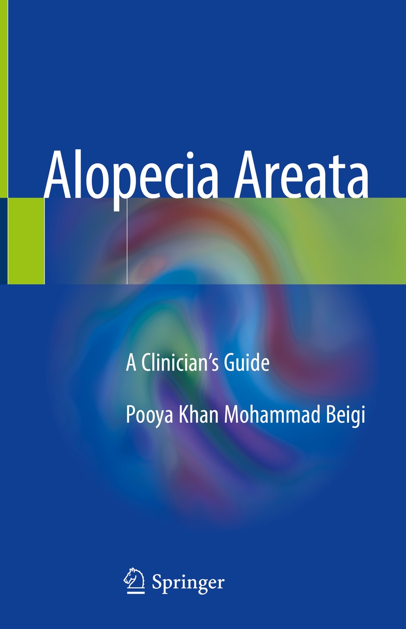 Titlebook: Alopecia Areata; A Clinician‘s Guide Pooya Khan Mohammad Beigi Book 2018 Springer International Publishing AG, part of Springer Nature 2018 Titlebook: Alopecia Areata; A Clinician‘s Guide Pooya Khan Mohammad Beigi Book 2018 Springer International Publishing AG, part of Springer Nature 2018