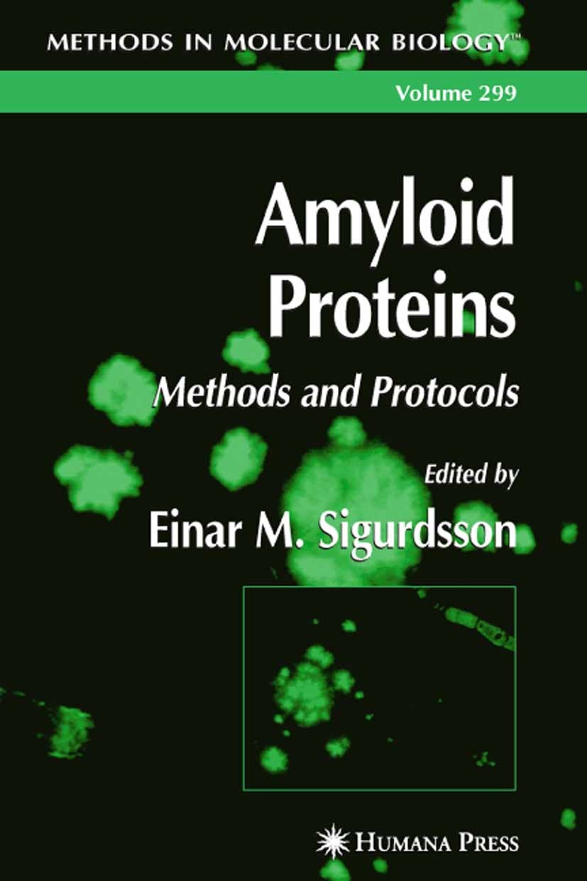 Titlebook: Amyloid Proteins; Einar M. Sigurdsson Book 20051st edition Humana Press 2005 ELISA.Termination.Vivo.biology.electron microscopy.molecular Titlebook: Amyloid Proteins; Einar M. Sigurdsson Book 20051st edition Humana Press 2005 ELISA.Termination.Vivo.biology.electron microscopy.molecular