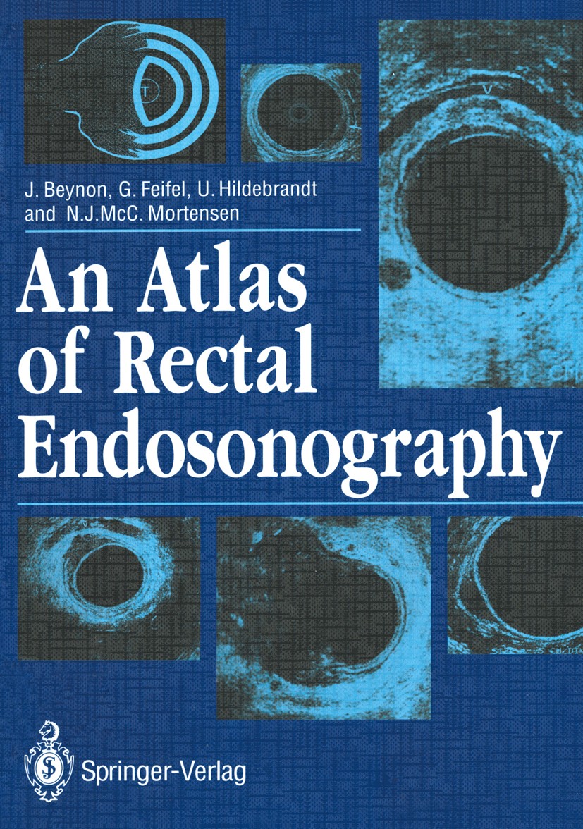 Titlebook: An Atlas of Rectal Endosonography; J. Beynon,G. Feifel,N. J. McC. Mortensen Book 1991 Springer-Verlag London Limited 1991 Endoluminal ultr Titlebook: An Atlas of Rectal Endosonography; J. Beynon,G. Feifel,N. J. McC. Mortensen Book 1991 Springer-Verlag London Limited 1991 Endoluminal ultr