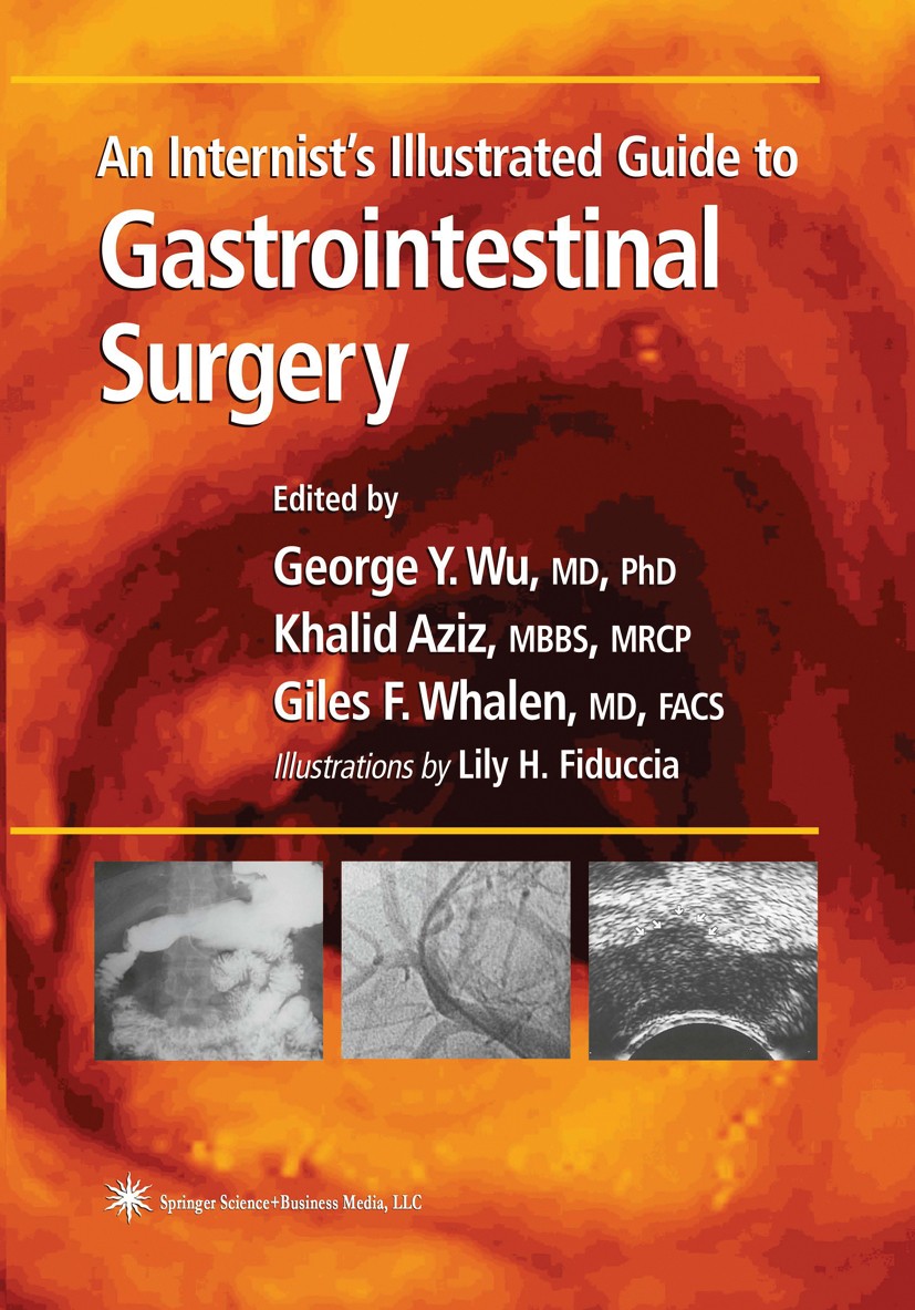 Titlebook: An Internist’s Illustrated Guide to Gastrointestinal Surgery; George Y. Wu (Professor of Medicine, Chief, Herman Book 2003 Springer Scienc Titlebook: An Internist’s Illustrated Guide to Gastrointestinal Surgery; George Y. Wu (Professor of Medicine, Chief, Herman Book 2003 Springer Scienc