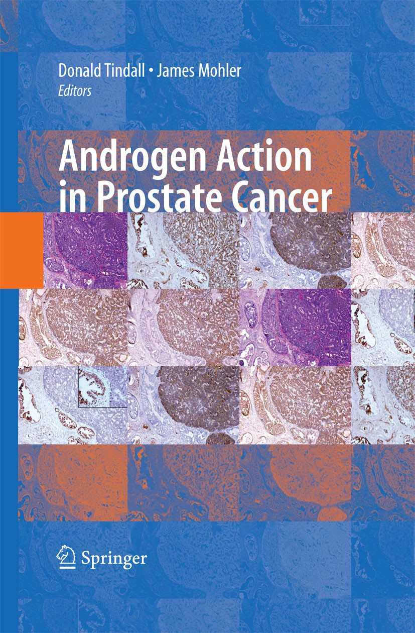Titlebook: Androgen Action in Prostate Cancer; James Mohler,Donald Tindall Book 2009 Springer-Verlag New York 2009 DNA.Drogen.gene expression.genes.i Titlebook: Androgen Action in Prostate Cancer; James Mohler,Donald Tindall Book 2009 Springer-Verlag New York 2009 DNA.Drogen.gene expression.genes.i