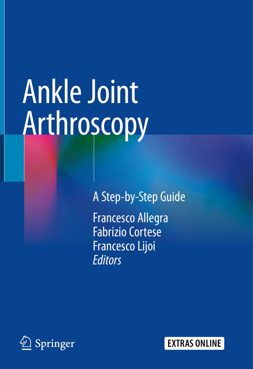 Titlebook: Ankle Joint Arthroscopy; A Step-by-Step Guide Francesco Allegra,Fabrizio Cortese,Francesco Lijoi Book 2020 Springer Nature Switzerland AG 2 Titlebook: Ankle Joint Arthroscopy; A Step-by-Step Guide Francesco Allegra,Fabrizio Cortese,Francesco Lijoi Book 2020 Springer Nature Switzerland AG 2