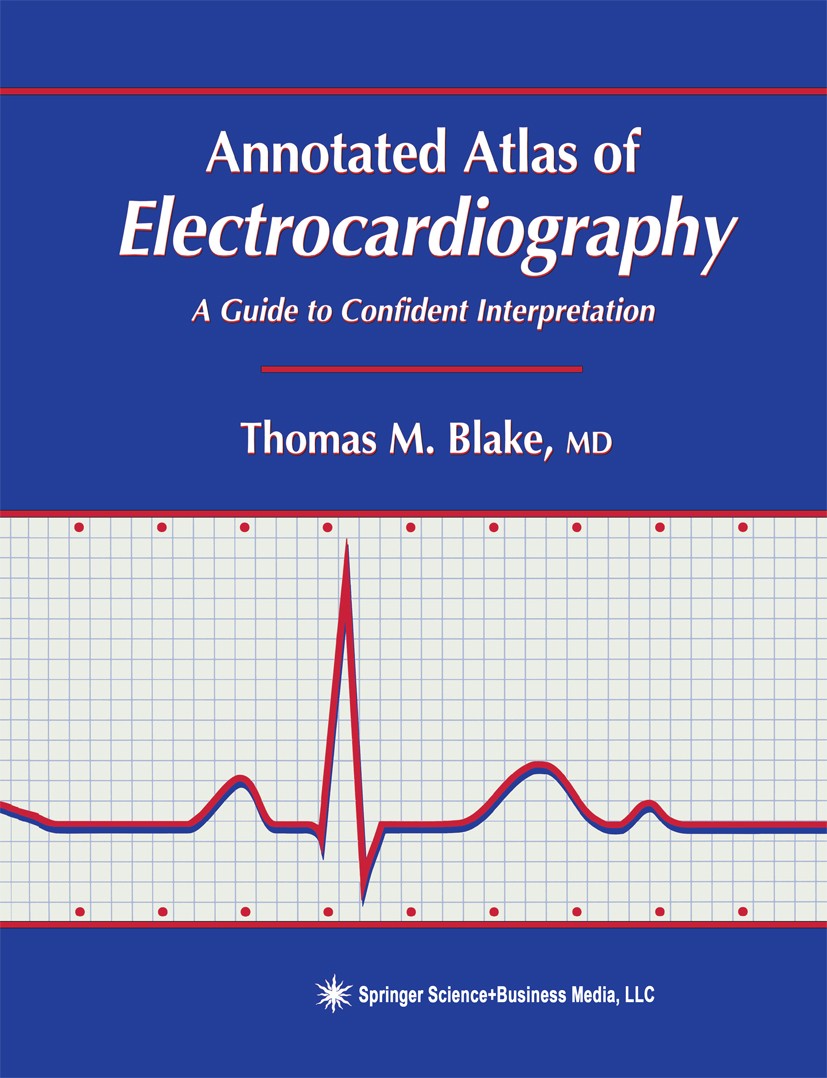 Titlebook: Annotated Atlas of Electrocardiography; A Guide to Confident Thomas M. Blake Book 1999 Springer Science+Business Media New York 1999 cognit Titlebook: Annotated Atlas of Electrocardiography; A Guide to Confident Thomas M. Blake Book 1999 Springer Science+Business Media New York 1999 cognit