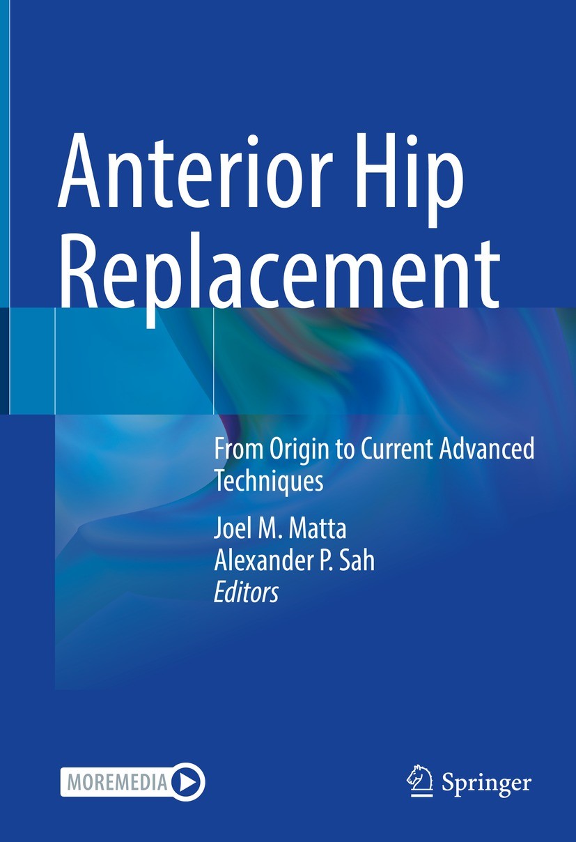 Titlebook: Anterior Hip Replacement; From Origin to Curre Joel M. Matta,Alexander P. Sah Book 2022 The Editor(s) (if applicable) and The Author(s), un Titlebook: Anterior Hip Replacement; From Origin to Curre Joel M. Matta,Alexander P. Sah Book 2022 The Editor(s) (if applicable) and The Author(s), un