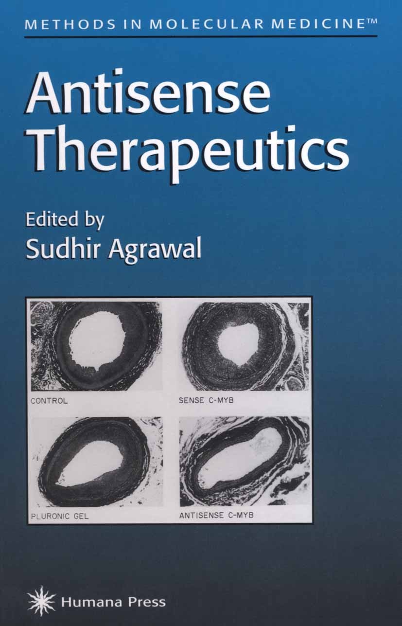 Titlebook: Antisense Therapeutics; Sudhir Agrawal Book 19961st edition Humana Press 1996 Titlebook: Antisense Therapeutics; Sudhir Agrawal Book 19961st edition Humana Press 1996