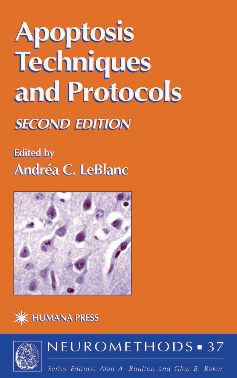 Titlebook: Apoptosis Techniques and Protocols; Andréa C. LeBlanc Book 2002Latest edition Humana Press 2002 Titlebook: Apoptosis Techniques and Protocols; Andréa C. LeBlanc Book 2002Latest edition Humana Press 2002