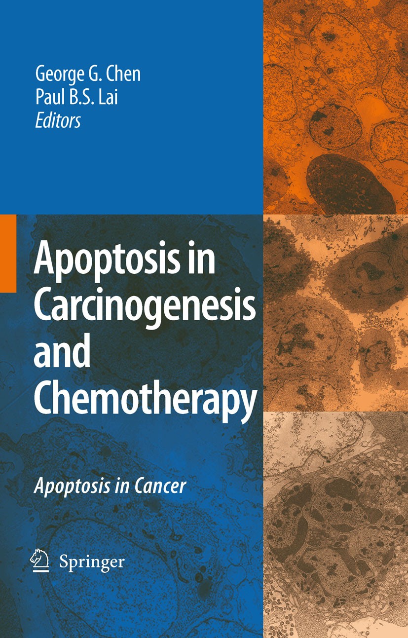 Titlebook: Apoptosis in Carcinogenesis and Chemotherapy; Apoptosis in cancer George G. Chen,Paul B.S. Lai Book 2009 Springer Science+Business Media B. Titlebook: Apoptosis in Carcinogenesis and Chemotherapy; Apoptosis in cancer George G. Chen,Paul B.S. Lai Book 2009 Springer Science+Business Media B.