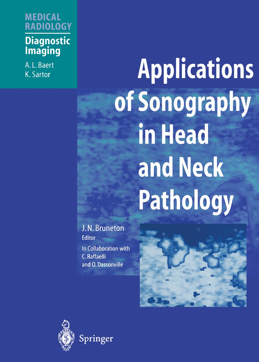 Titlebook: Applications of Sonography in Head and Neck Pathology; Jean Noël Bruneton Book 2002 Springer-Verlag Berlin Heidelberg 2002 Halsschlagader. Titlebook: Applications of Sonography in Head and Neck Pathology; Jean Noël Bruneton Book 2002 Springer-Verlag Berlin Heidelberg 2002 Halsschlagader.