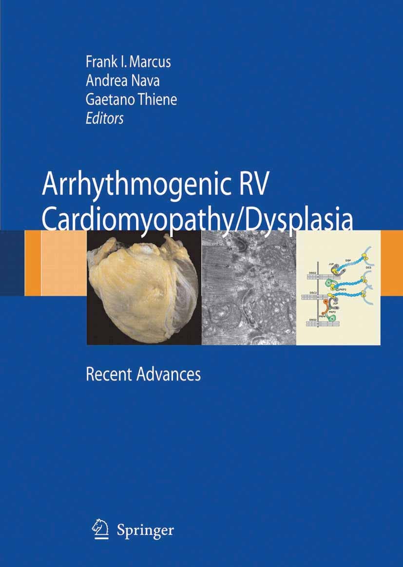 Titlebook: Arrhythmogenic RV Cardiomyopathy/Dysplasia; Recent Advances Frank I. Markus,Andrea Nava,Gaetano Thiene Book 20071st edition Springer-Verlag Titlebook: Arrhythmogenic RV Cardiomyopathy/Dysplasia; Recent Advances Frank I. Markus,Andrea Nava,Gaetano Thiene Book 20071st edition Springer-Verlag