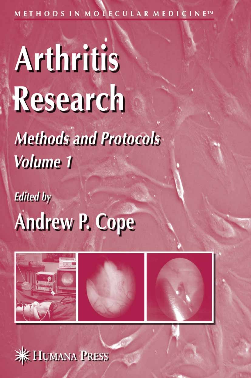 Titlebook: Arthritis Research; Volume 1: Methods an Andrew P. Cope Book 2007 Humana Press 2007 Arthritis.PCR.gene expression.gene transfer.genes.hybri Titlebook: Arthritis Research; Volume 1: Methods an Andrew P. Cope Book 2007 Humana Press 2007 Arthritis.PCR.gene expression.gene transfer.genes.hybri