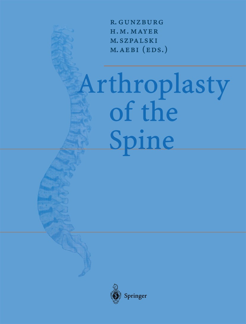 Titlebook: Arthroplasty of the Spine; Robert Gunzburg,Heinz Michael Mayer,Max Aebi Conference proceedings 2004 Springer-Verlag Berlin Heidelberg 2004 Titlebook: Arthroplasty of the Spine; Robert Gunzburg,Heinz Michael Mayer,Max Aebi Conference proceedings 2004 Springer-Verlag Berlin Heidelberg 2004